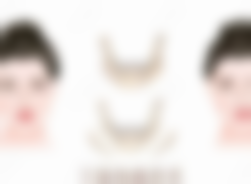 刘伟华医生真实实例：见证美丽蜕变