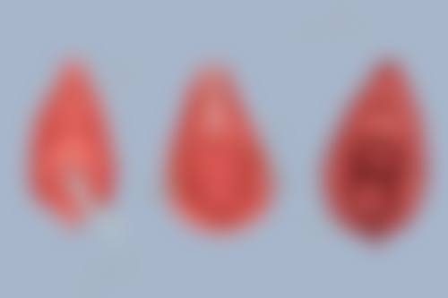 如何延长隆胸假体的使用时间