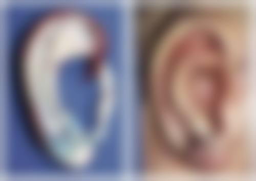 360环吸和水动力吸脂哪个安心性更高？