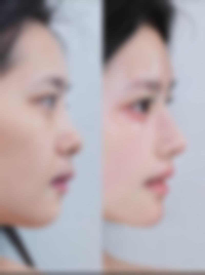 白城薇斯医疗美容门诊部擅长项目