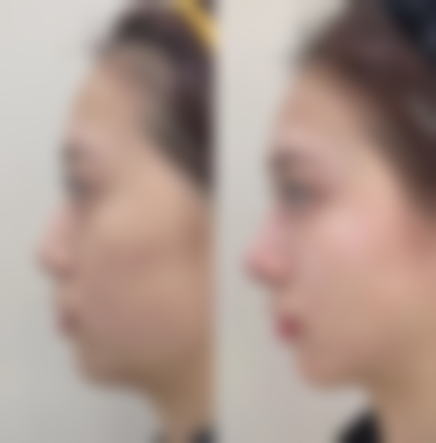 西安柏谚雅美容诊所地址及乘车路线