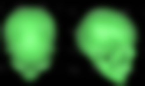 倍舒痕祛疤膏适合割双眼皮后用吗