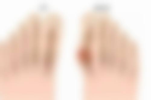 药物治疗能让淡红色疤痕变回肉色值不值