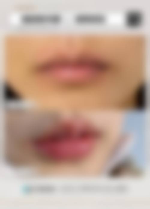 大连许英医疗整形美容诊所真实实例