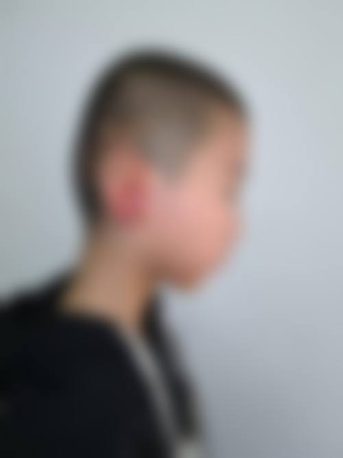 商丘缔莱美整形医院真实实例：见证美丽的奇迹