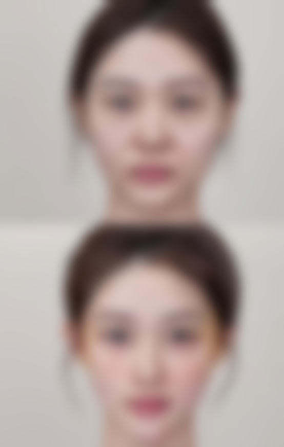 医美张升医生擅长项目