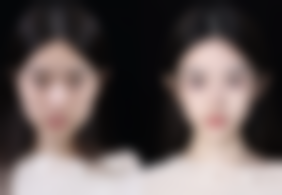 Shinebom 皮肤科真实实例：见证美丽蜕变