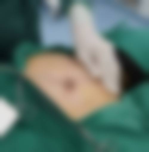 郑州新生整形美容医院擅长项目