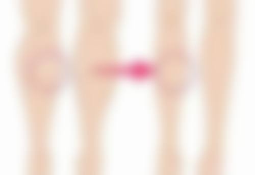 去除疤痕疙瘩的医美手段靠谱吗