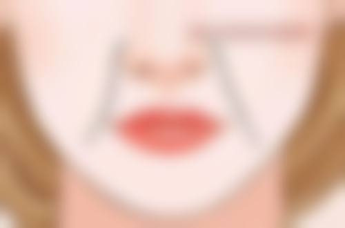 腹部抽脂瘦肚子有什么优势