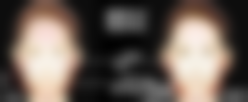 打瘦脸针苹果肌下垂的概率大吗