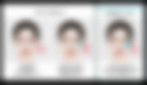 打完瘦脸针多久能看到明显成效?