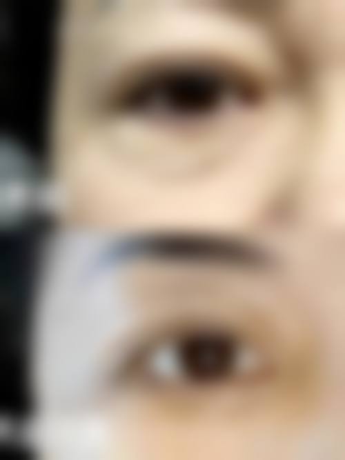 南通市第三人民医院烧伤整形美容科价格表