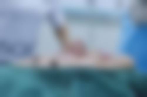 广州市第一人民医院整形科真实实例：见证美丽蜕变