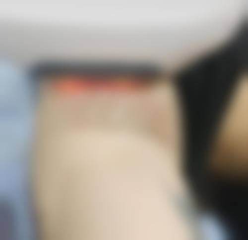 郑州新生整形美容医院口碑怎么样