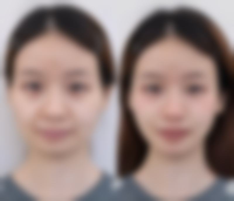 上海美尔雅徐海荣医生擅长项目