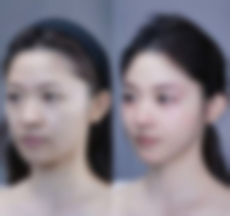 李夏永医生的真实实例