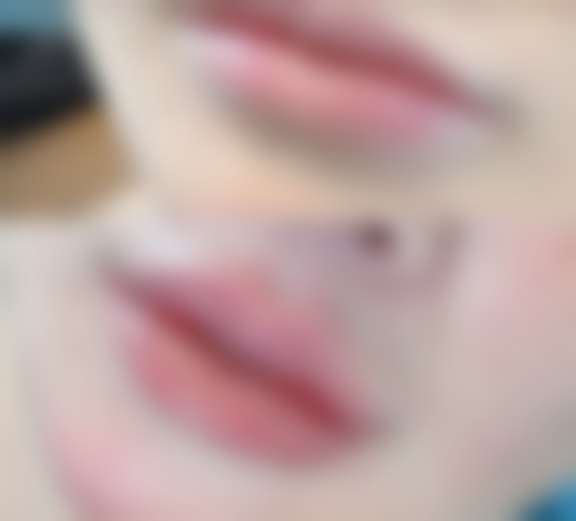 车尚勉医生的技术特点：创新与安心并重