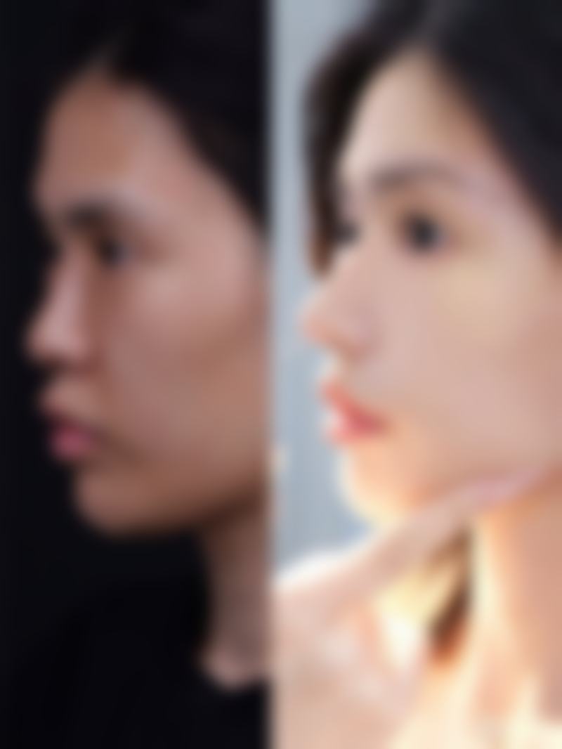 深圳沃美时光医疗美容诊所真实实例