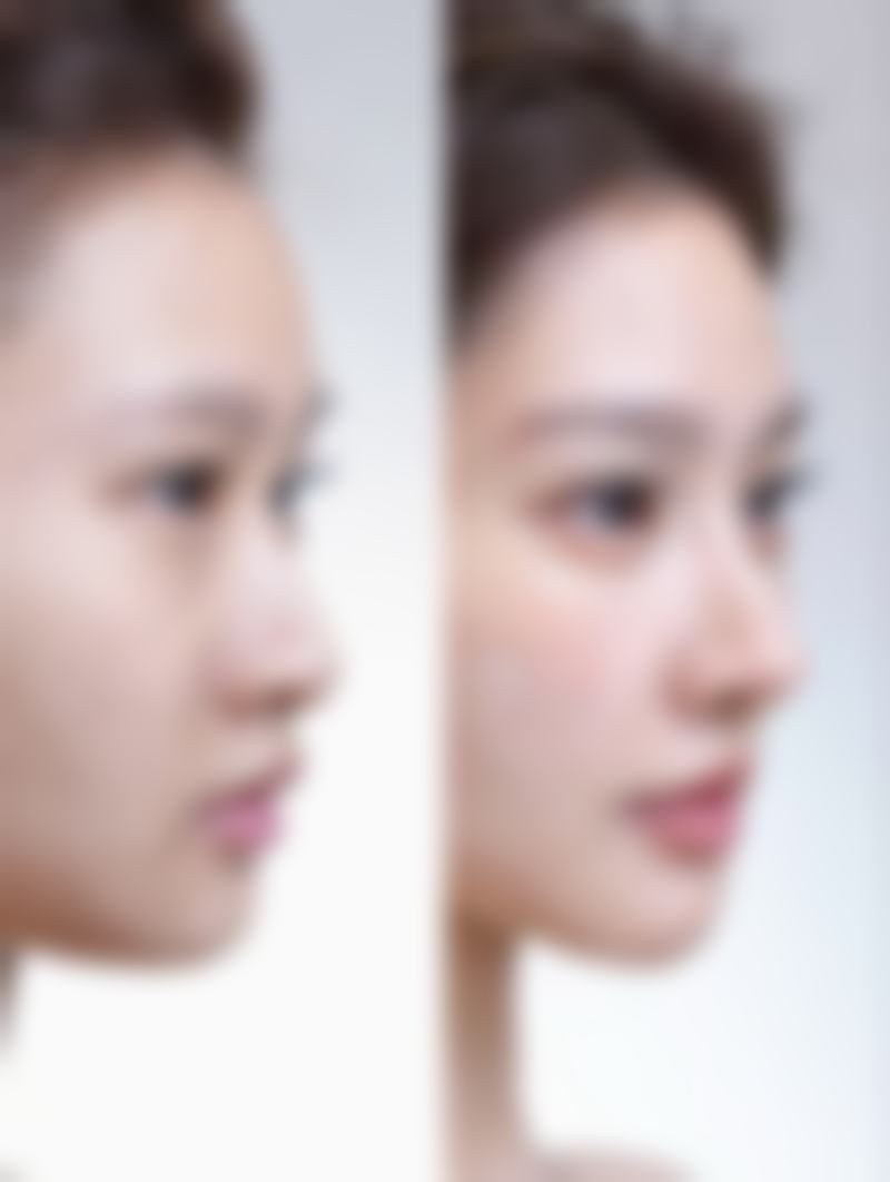 廊坊那美国内外医疗整形医院擅长项目:打造多样美