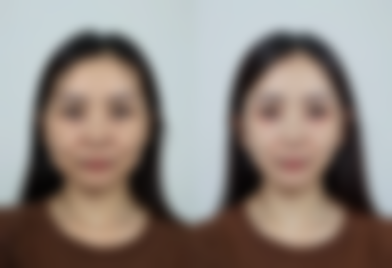 广州市第一人民医院整形科地址及乘车路线：轻松找到变得更美之地