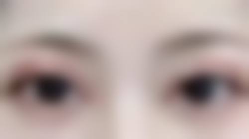 李茂军 医生的看诊优势