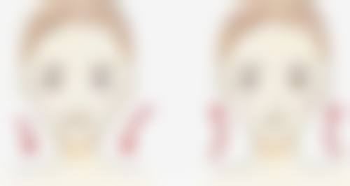 做了双眼皮修复自然的黄金修复期是什么时候