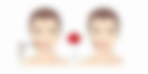 李茂军 医生擅长的泌尿外科项目