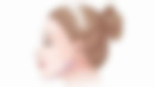 把增生疤痕割掉术后疤痕平整美观靠谱吗