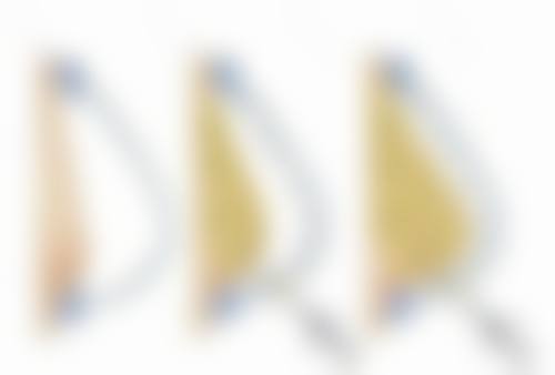 把增生疤痕割掉修复快是真的吗