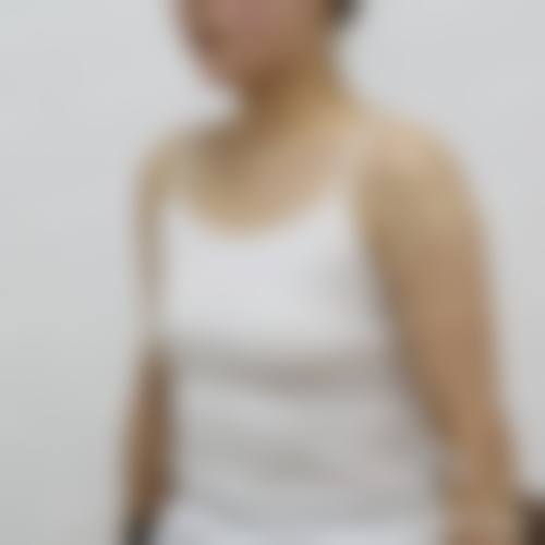 赤峰市医院烧伤整形美容科擅长项目