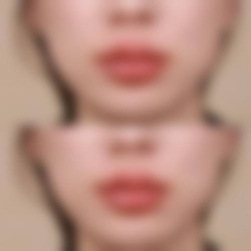 赤峰市医院烧伤整形美容科营业时间