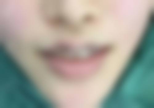 成都元辰医疗美容医院仪器设备：国内外同步，科技塑美