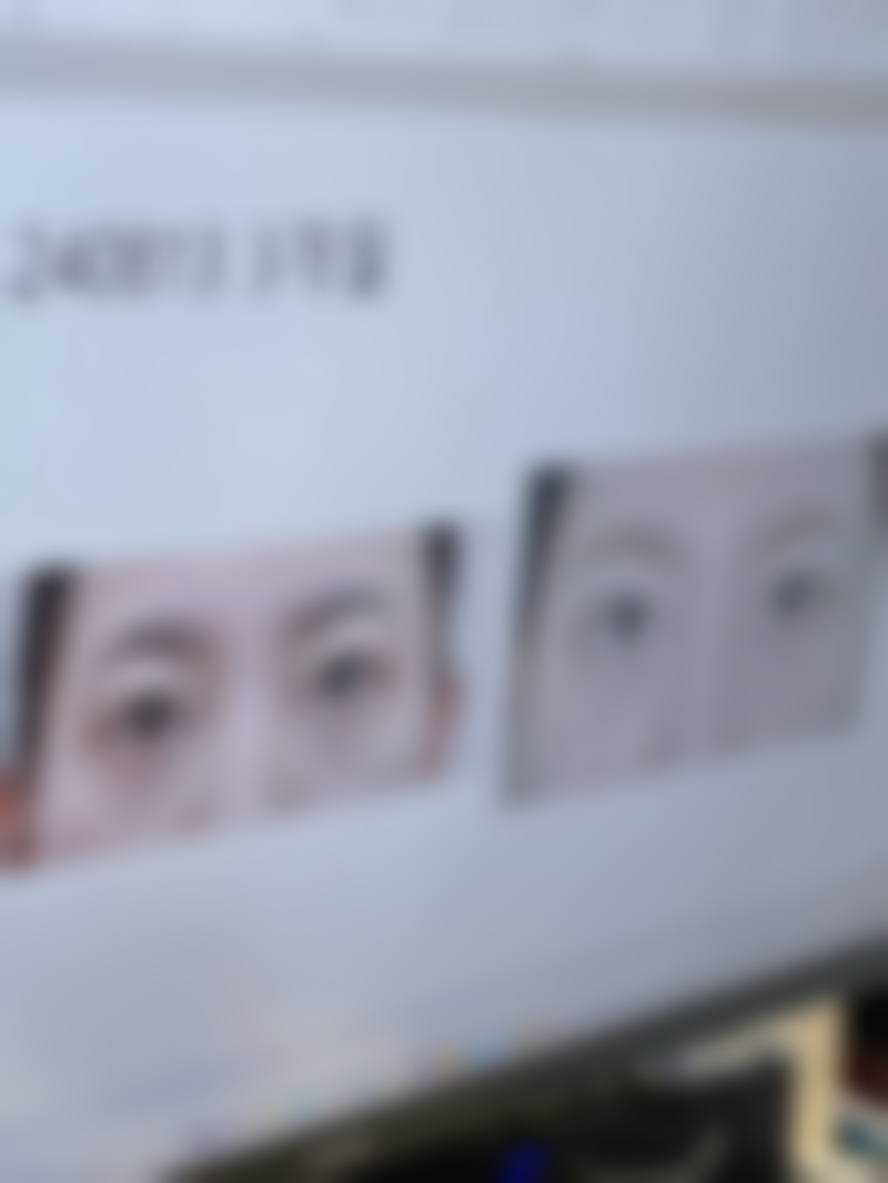 山东临沂米娅整形医院口碑怎么样