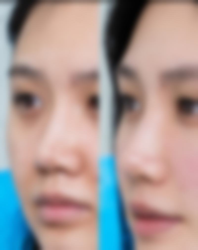 首延整形外科仪器设备：精良科技铸就美丽