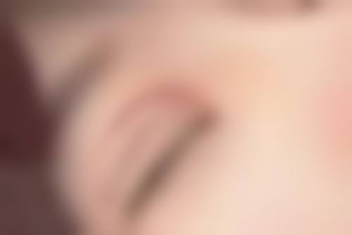 医美祛疤术靠谱吗