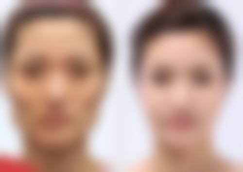 郭华峰医生看诊优势