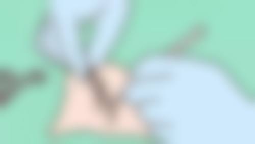 按摩护理对脸部疤痕修复有帮助吗？