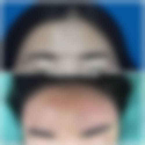 兰州诗丽堂澜悦医疗美容诊所擅长项目