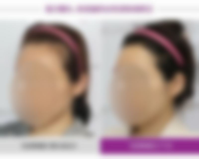 何苗医生坐诊医院:优质平台,保护美丽