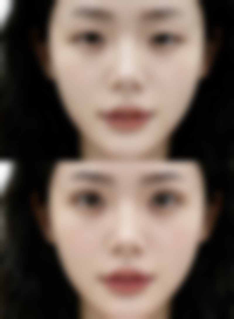 瘦脸针导致面部僵硬怎么样