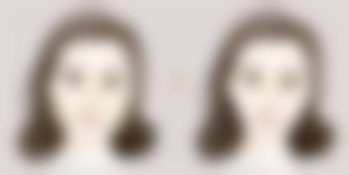 背部吸脂感染的概率靠谱吗