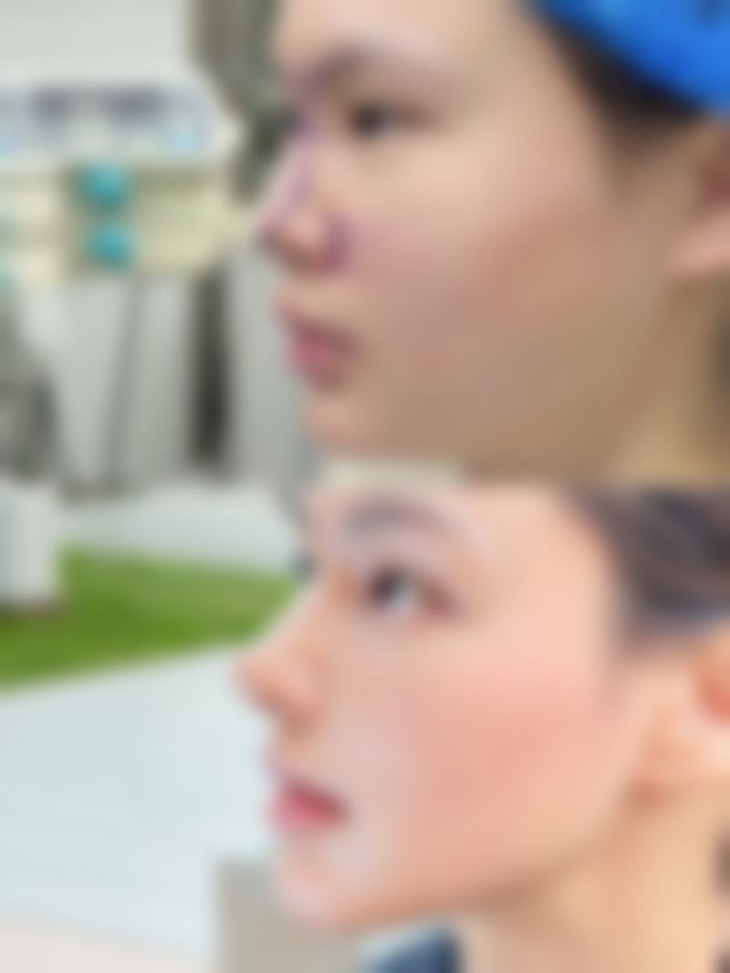 韩国鼻整形研究所