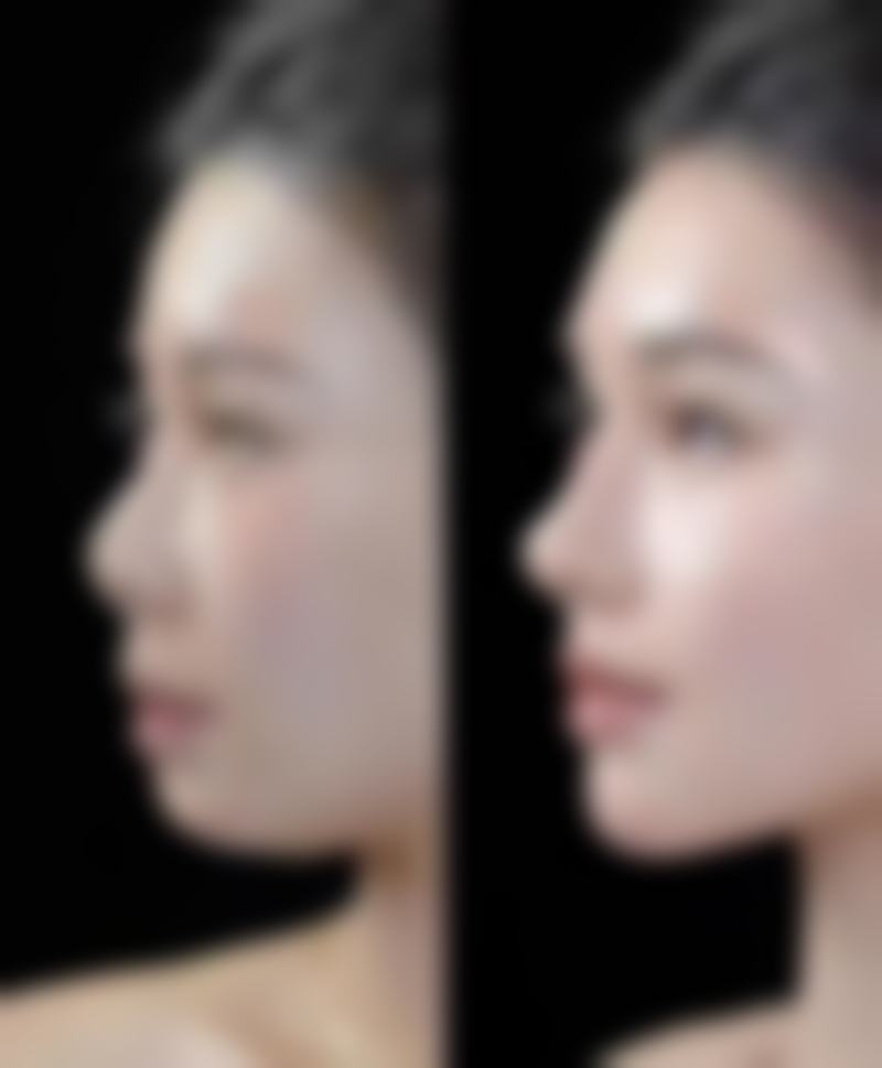 廊坊颐美佳整形医疗美容医院预约挂号方式