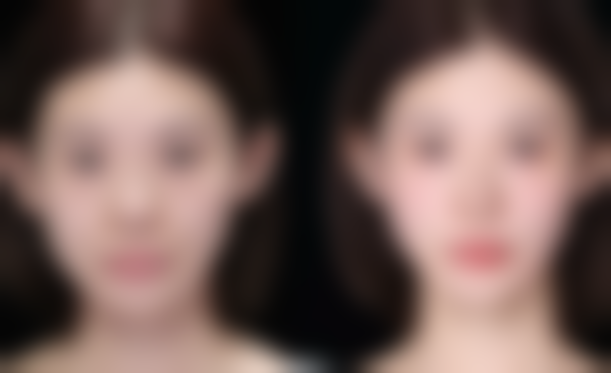 韩国鼻整形研究所