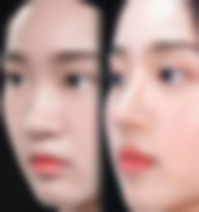 韩国鼻整形研究所