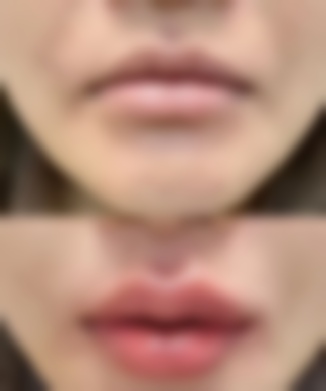 韩国鼻整形研究所