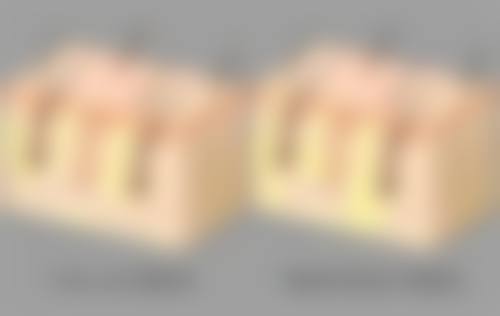 烧伤疤痕淡化时间值不值等待