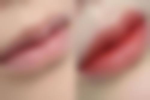 西安欧飒美拉医疗美容诊所真实实例