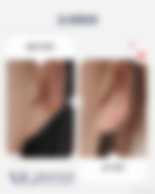 杭州美联致美医疗美容诊所真实实例：见证美丽蜕变